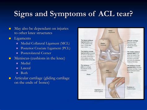 signs of a torn acl